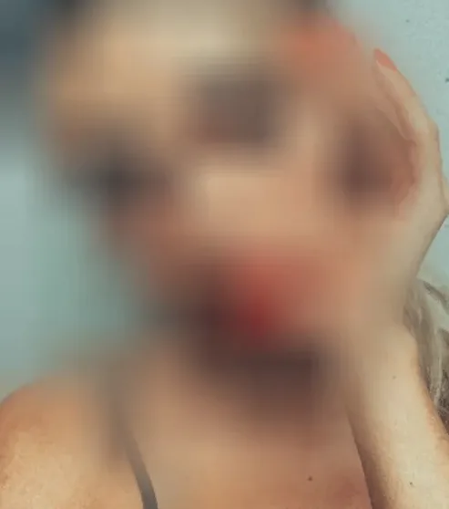 Leire, 37 años